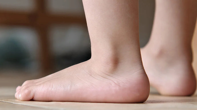 Top 7 Shoe Insoles for Flat Feet to Maximize Support